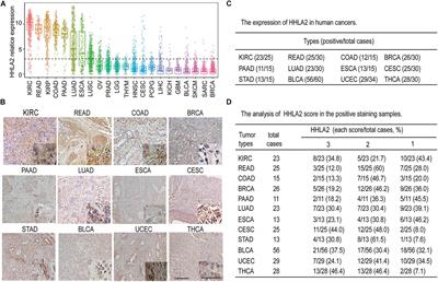 Over-Expression and Prognostic Significance of HHLA2, a New Immune Checkpoint Molecule, in Human Clear Cell Renal Cell Carcinoma